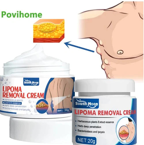Herbal Lipoma Removal Cream Tube